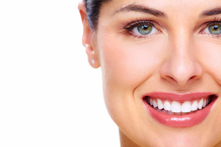 bonding-or-veneers