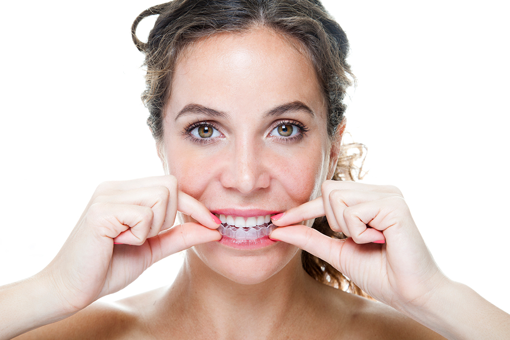 Invisalign in Windsor: Straighten Your Smile Without the Metal