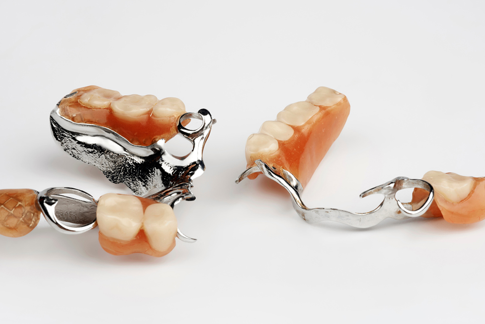 Partial dentures consultation and fitting at Foresto Dentistry Windsor Ontario